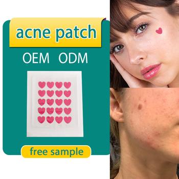 Acne Patch